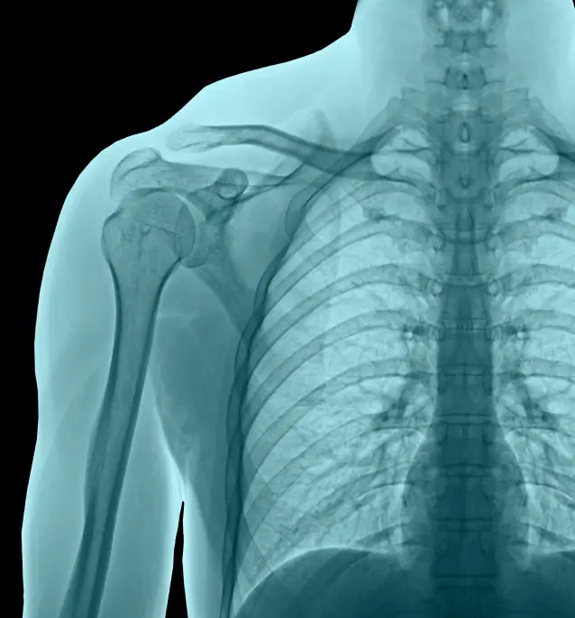 Online X-Ray Reporting by Qualified Radiologists - Maya Teleradiology Services